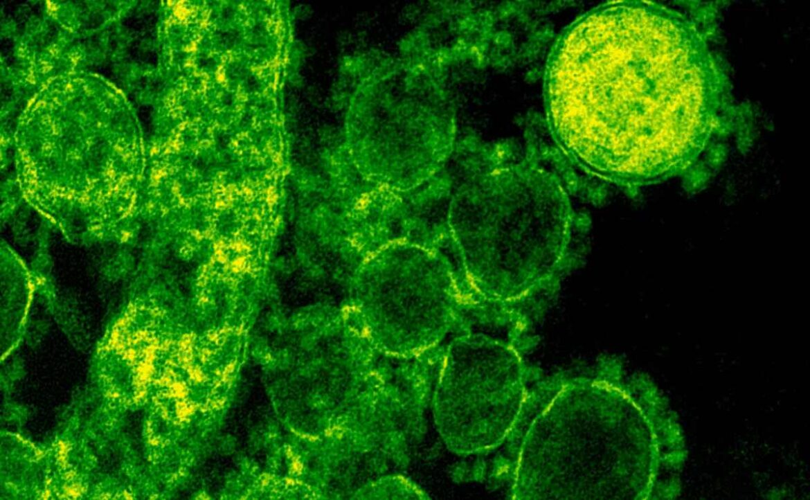 El gobierno federal confirmó el primer caso de rabia humana en Quintana Roo, tras el deceso de una persona mordida por un gato en Cancún.